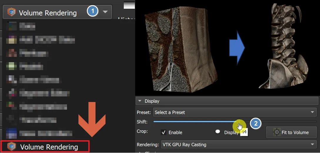 Volume rendering preset adjusting CT contrast in 3D Slicer