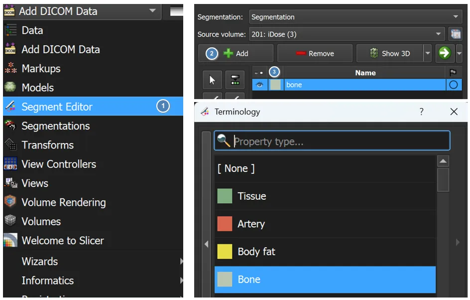 Creating a new segment in the 3D Slicer Segment Editor