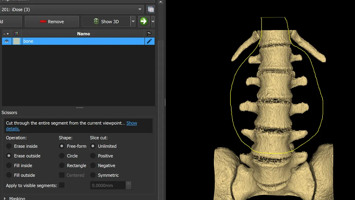 Scissors tool in Erase Outside mode isolating the region of interest