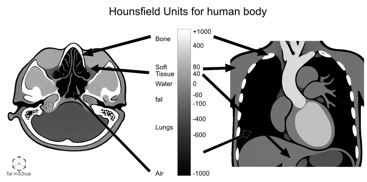From CT/MRI segmentation to a 3D-printed model, figure 3