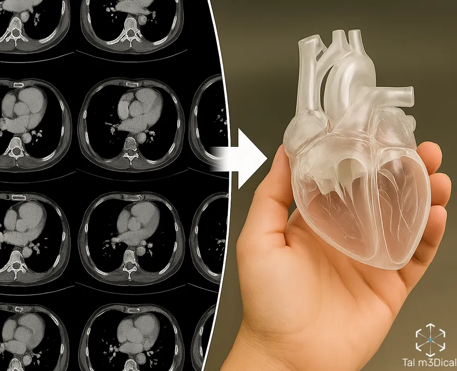 From CT/MRI segmentation to a 3D-printed model, figure 6