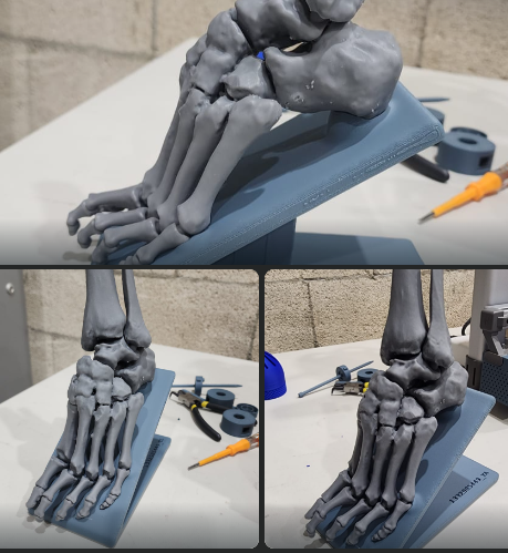 Anatomical bone model from CT data