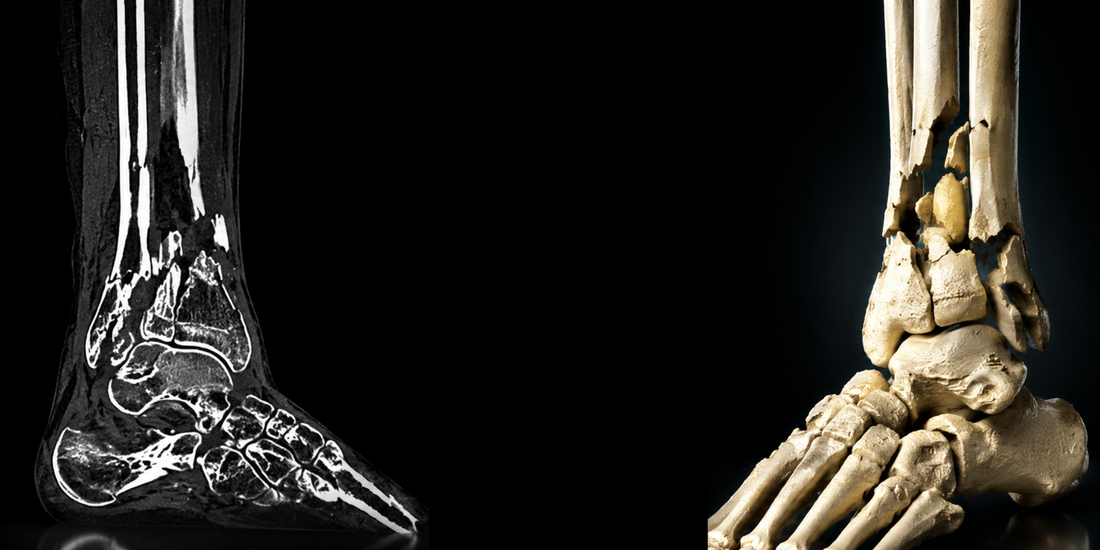 Bone anatomy reconstruction for R&D testing